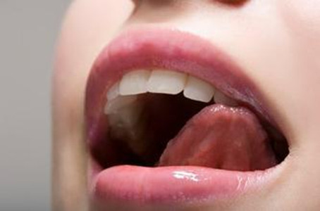 Comment savoir si vous devriez subir une gingivectomie ?