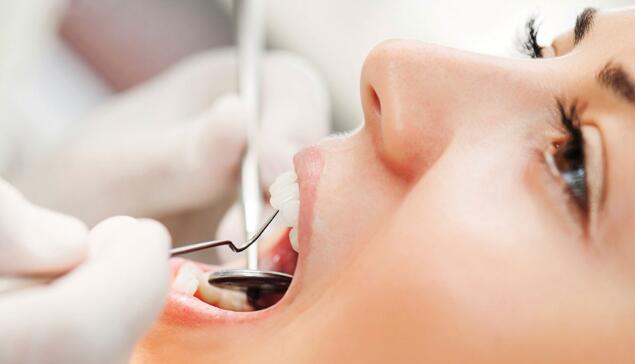 Récupération des dents de sagesse